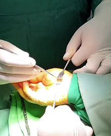 تامین هزینه عمل جراحی یک مادر سرپرست خانواده